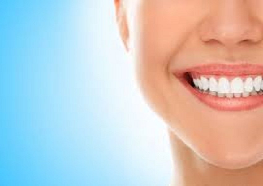 Hollywood Smile